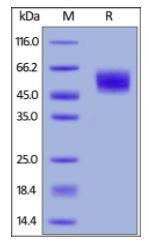 Human MICA, His Tag on SDS-PAGE under reducing (R) condition. The gel was stained overnight with Coomassie Blue. The purity of the protein is greater than 95%.